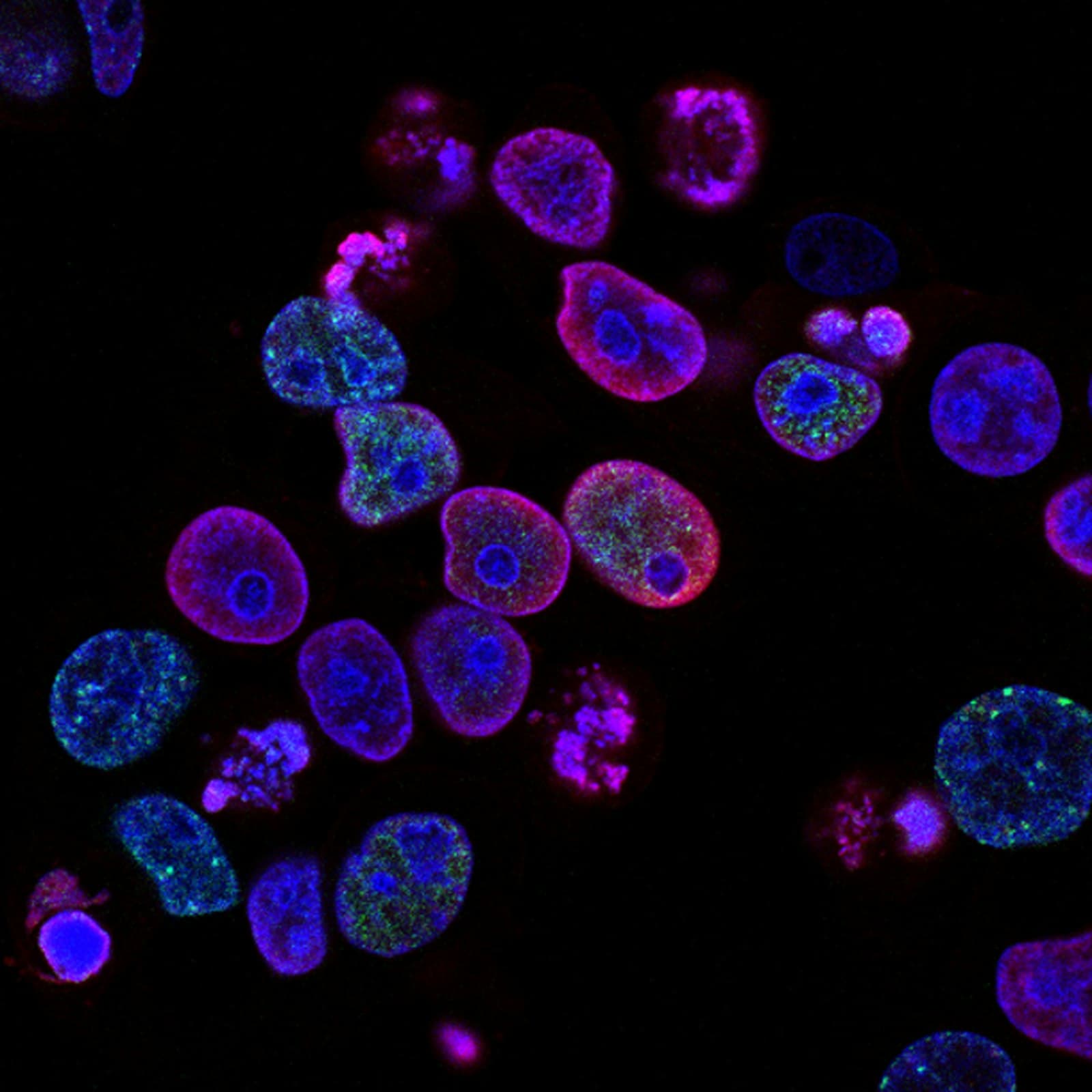Legionella analysis and speciation at Air Allergen